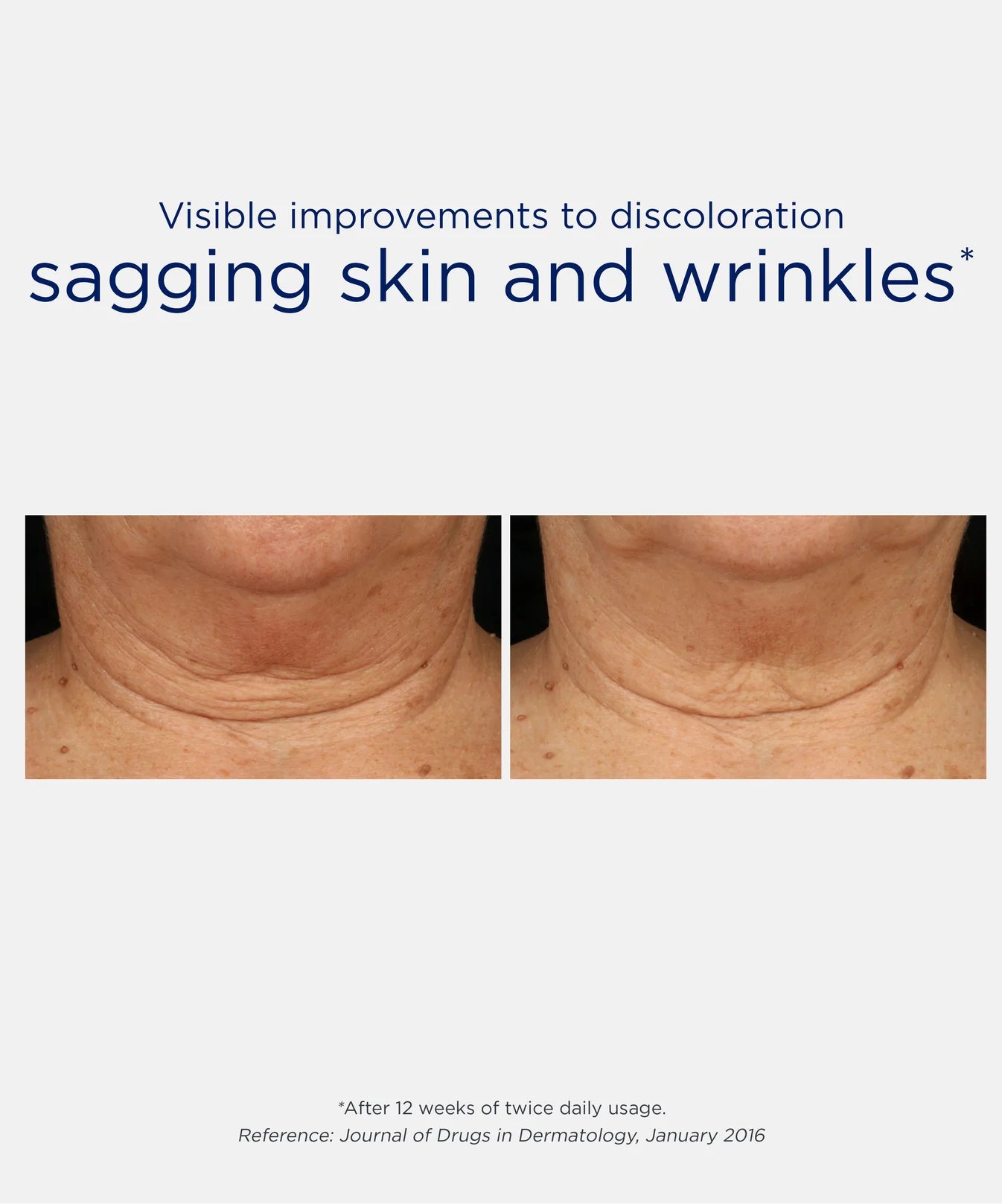 Triple Firming Neck
