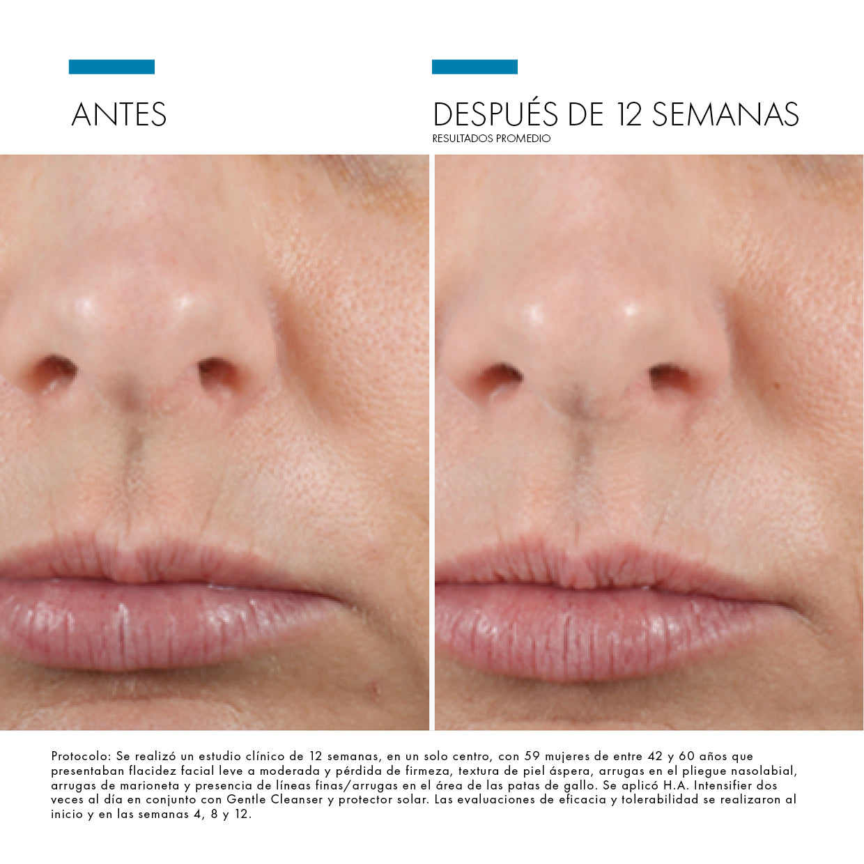 HA Intensifier / Skinceuticals